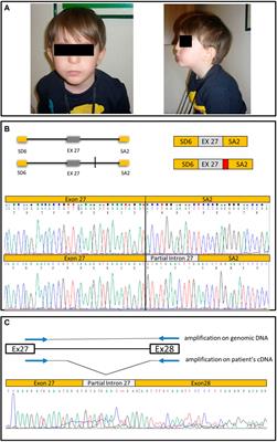 Frontiers Case Report Functional Characterization Of A Novel Chd